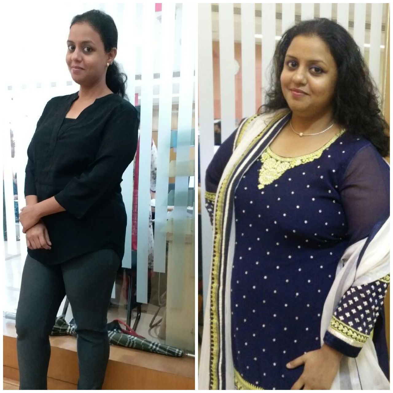 Hair-fall after bariatric surgery - Dr. Aparna Govil Bhasker